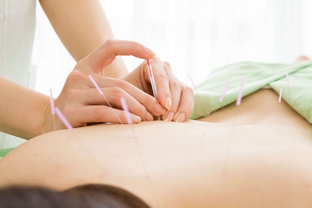 acupuncture massage